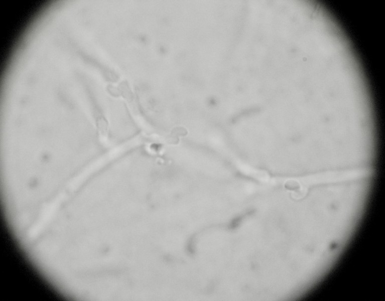 Antrodia? (Antrodia alpina)